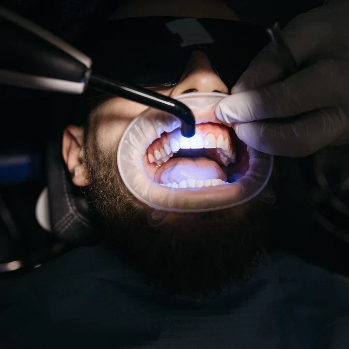 Why doesn't the Dental pod have a UV light? (2025)